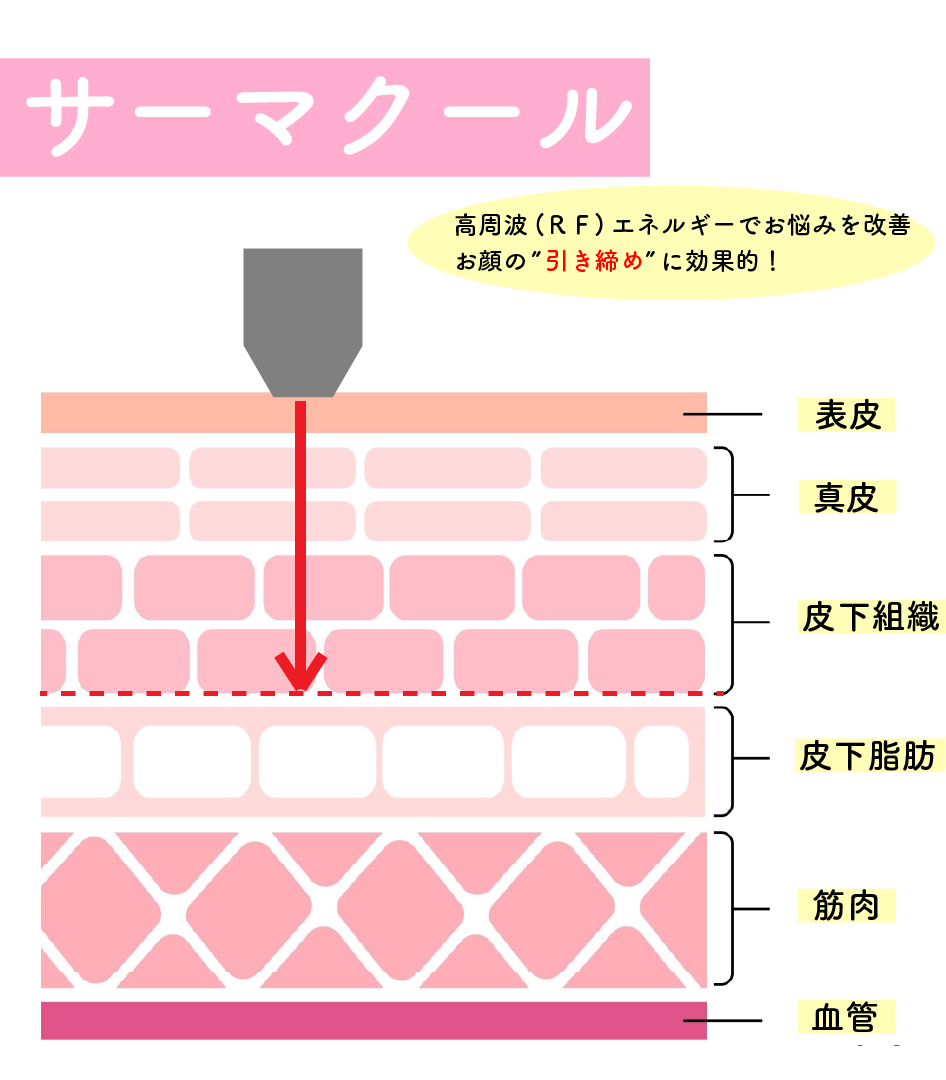 サーマクールとは？