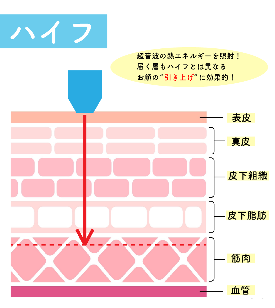 ハイフとは？
