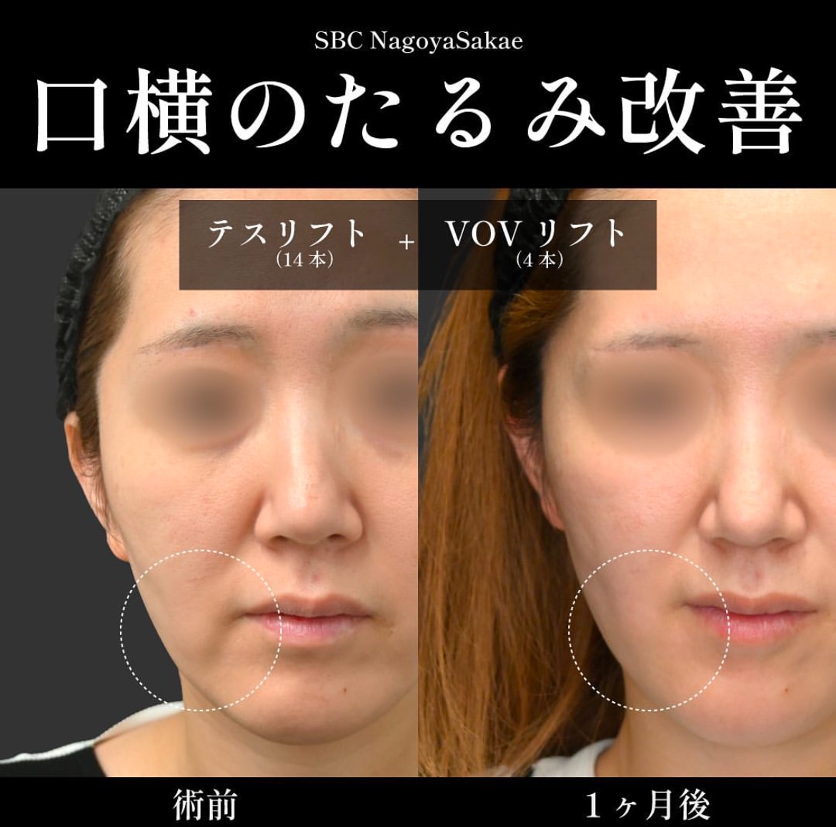 症例