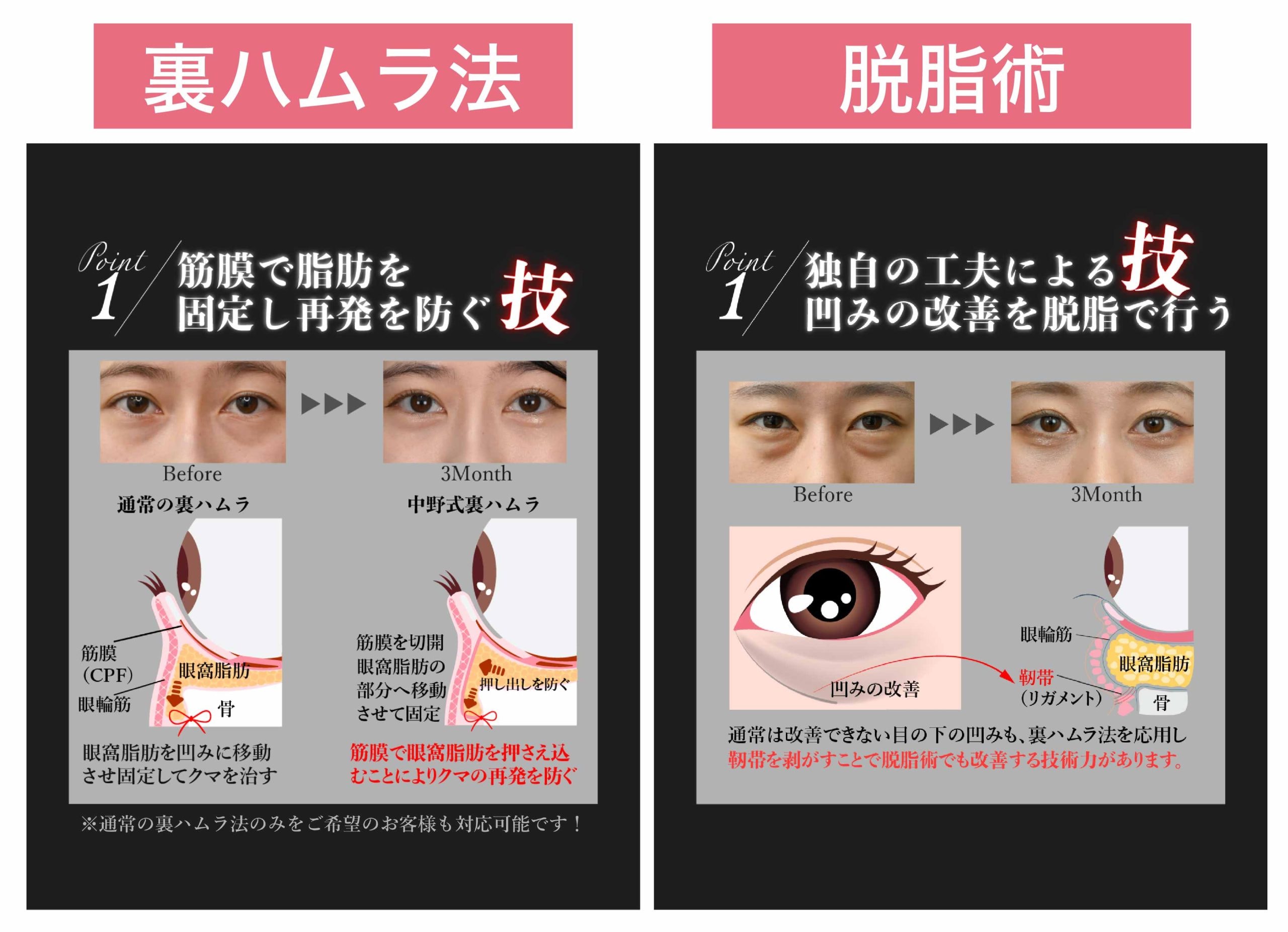3つの治療法をご紹介