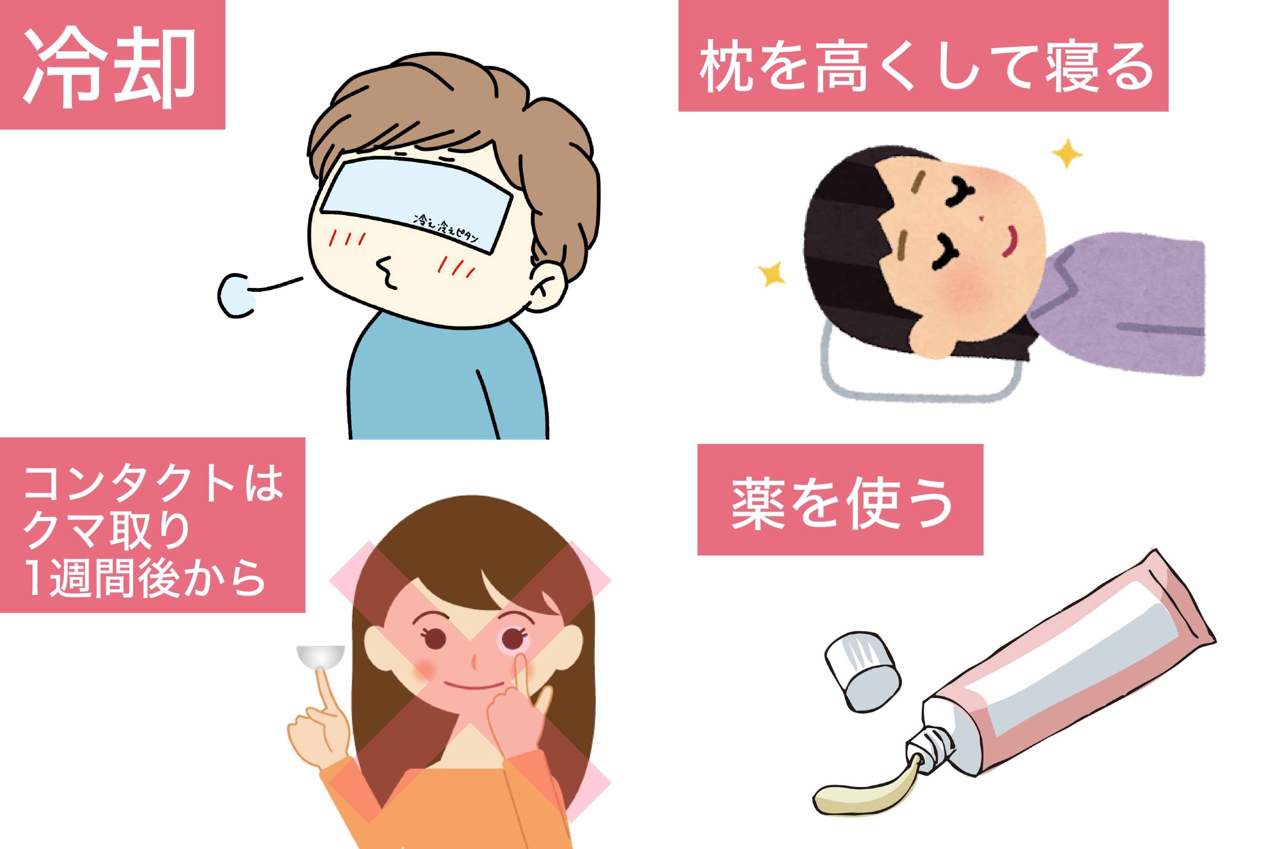 ダウンタイムの過ごし方