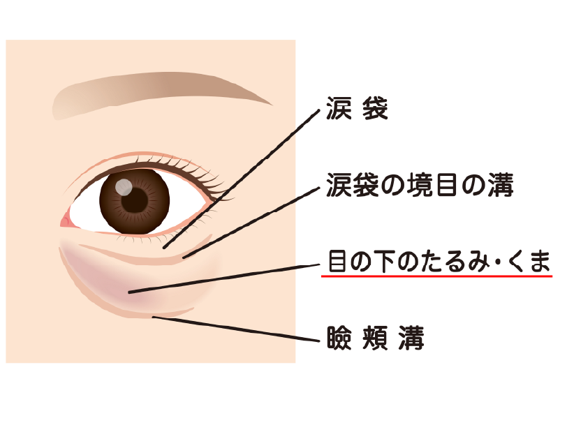 よりクマが酷く見える可能性が...