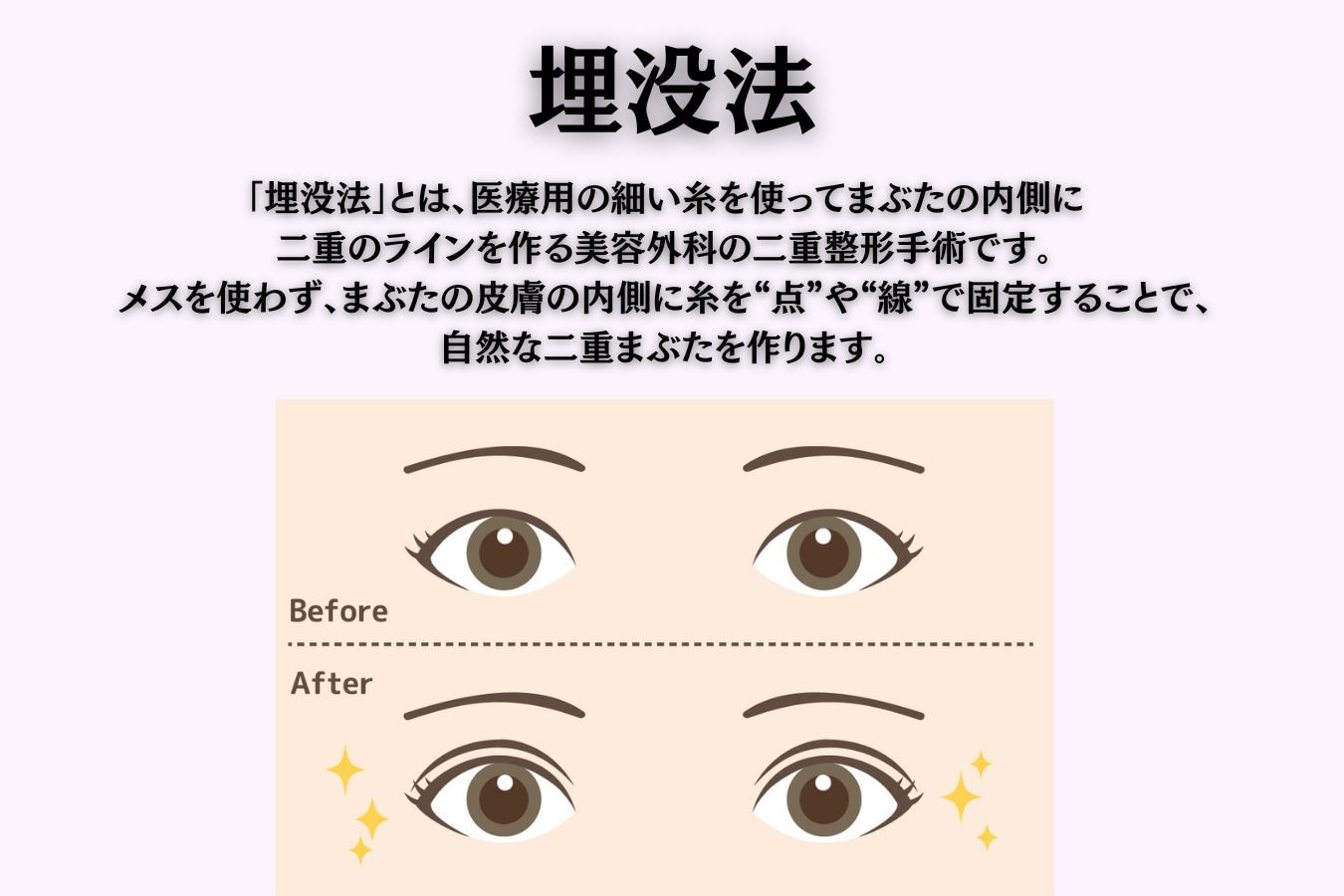 メリット