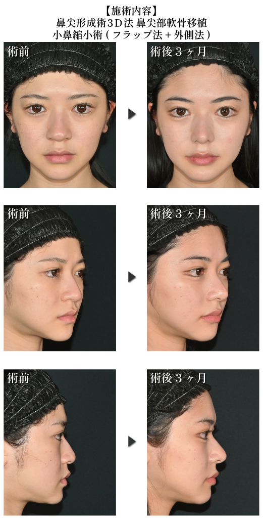 中野医師の厳選症例③