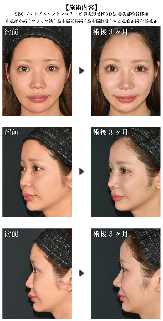 中野医師の厳選症例④