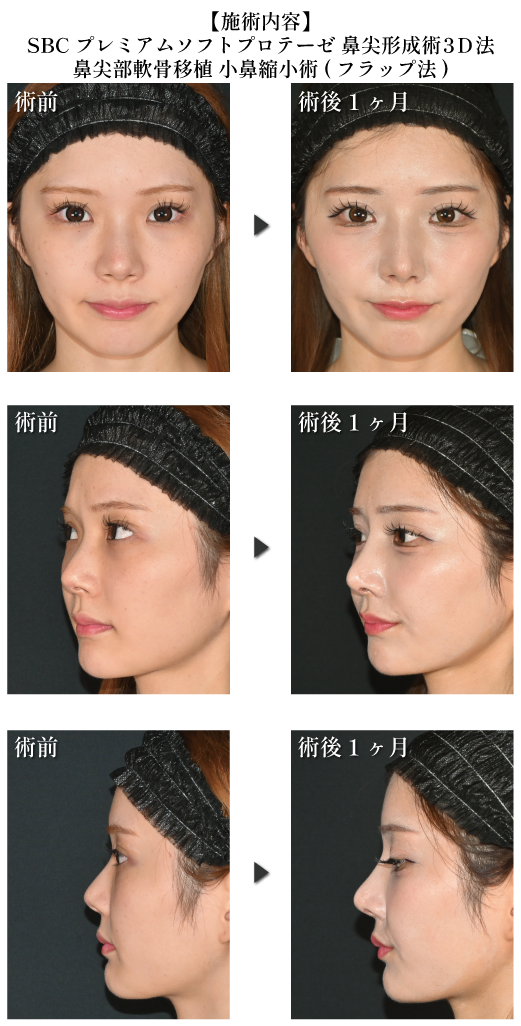 中野医師の厳選症例②