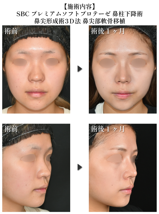 中野医師の厳選症例①