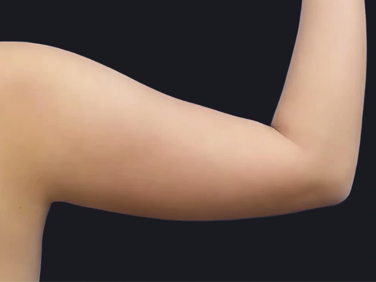 太ももの隙間やほっそりとした二の腕を手っ取り早く痩せたいなら