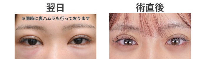 当日から翌日