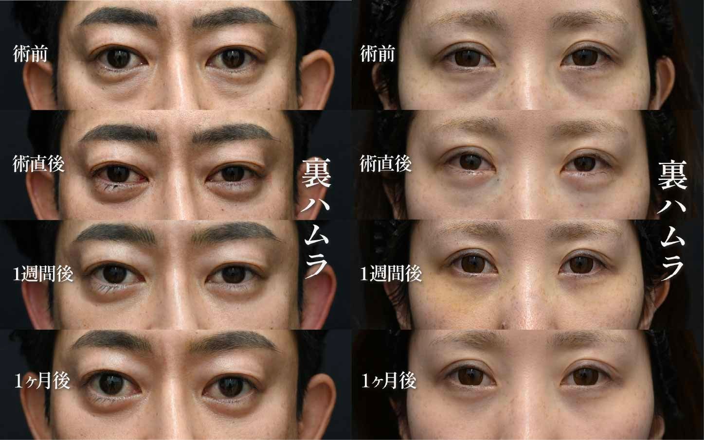 裏ハムラの良いところ