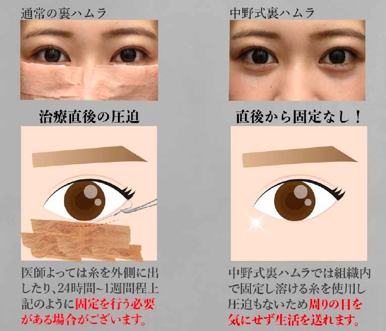 もう一つ利点が!?
