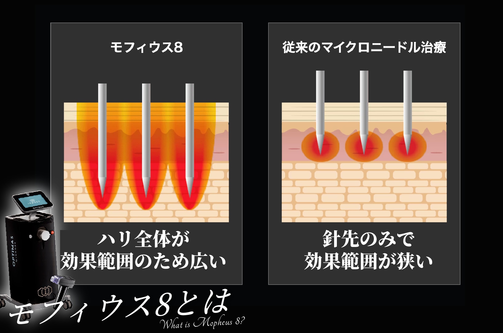 従来の治療との違い