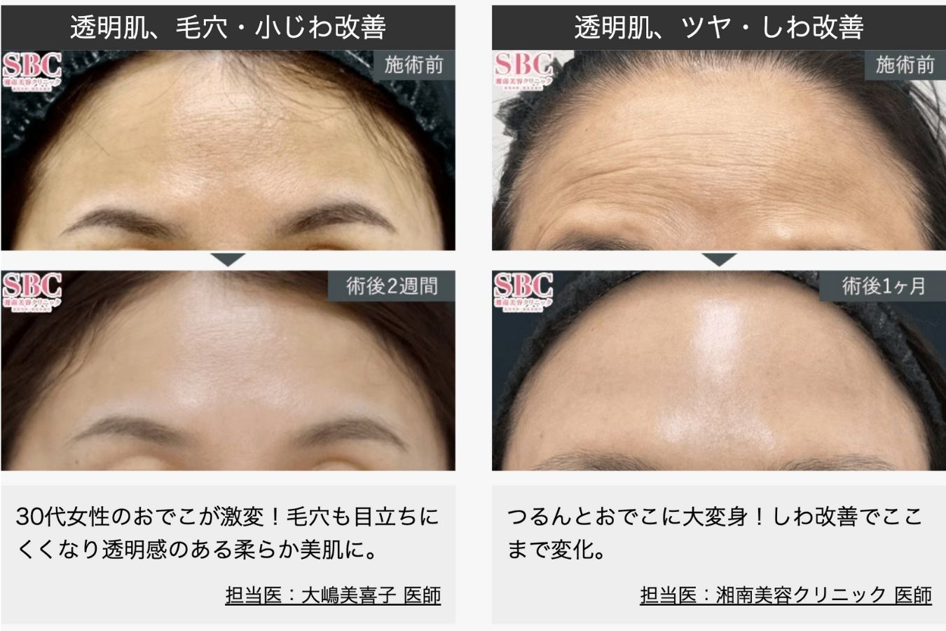 女優注射®の主な効果
