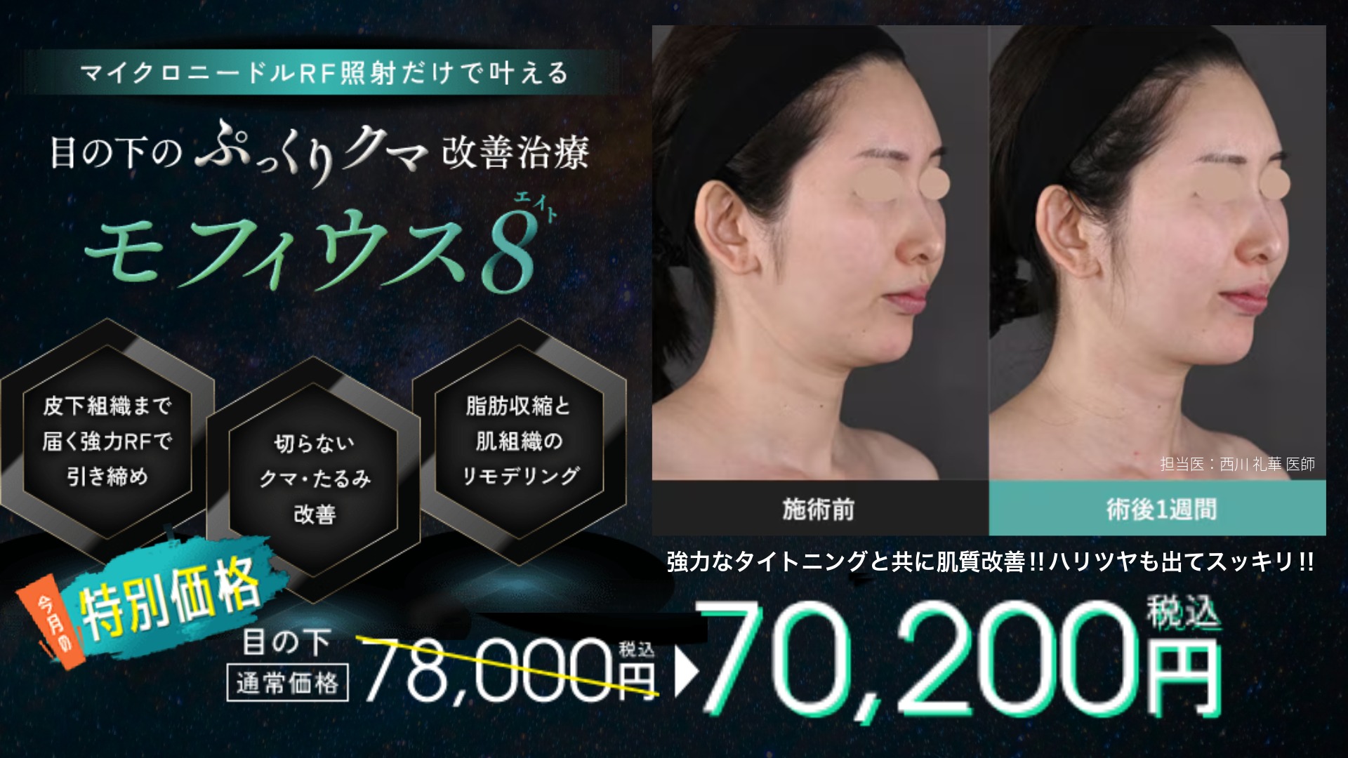 0811_app_モフィウス8-3