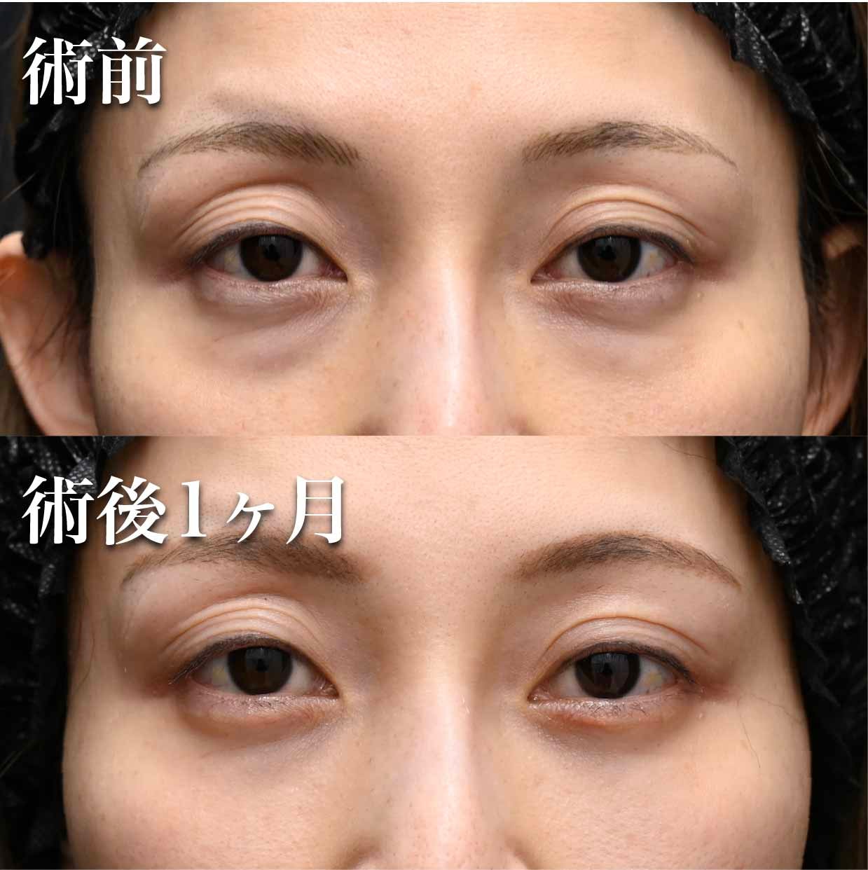色味改善の効果