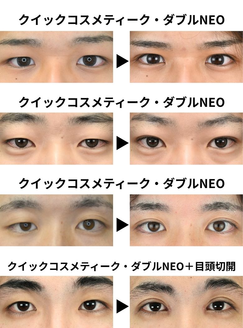 症例写真ご紹介
