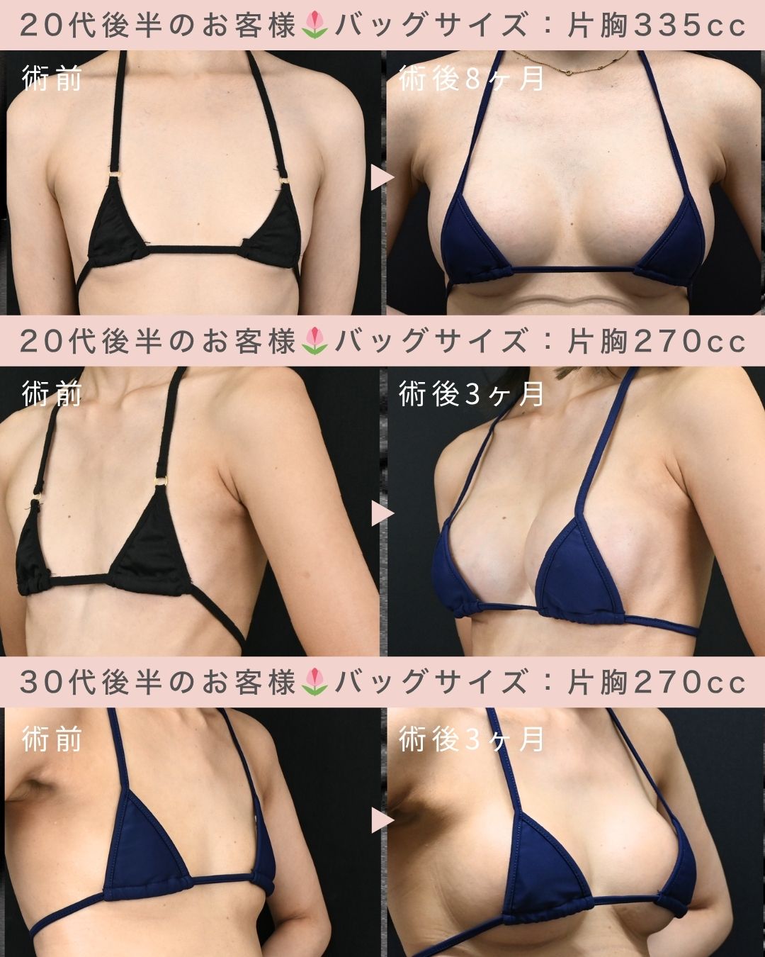 Motivaエルゴノミックス2の症例を見ていきましょう！
