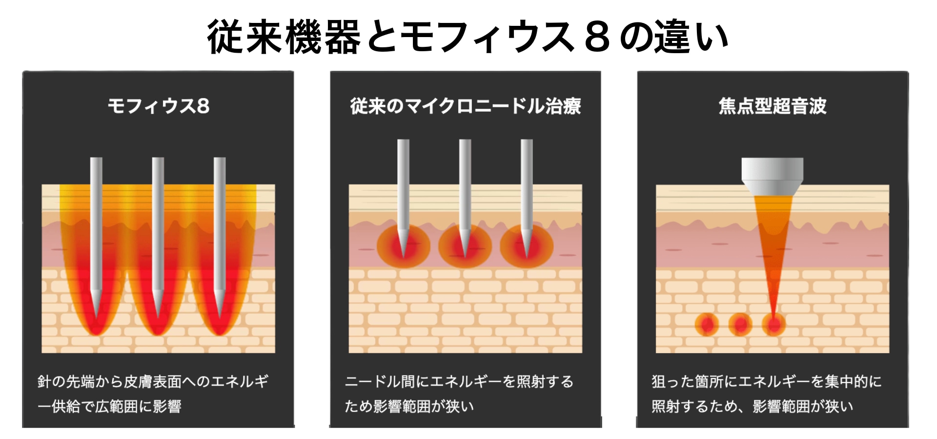 モフィウス8が選ばれる理由
