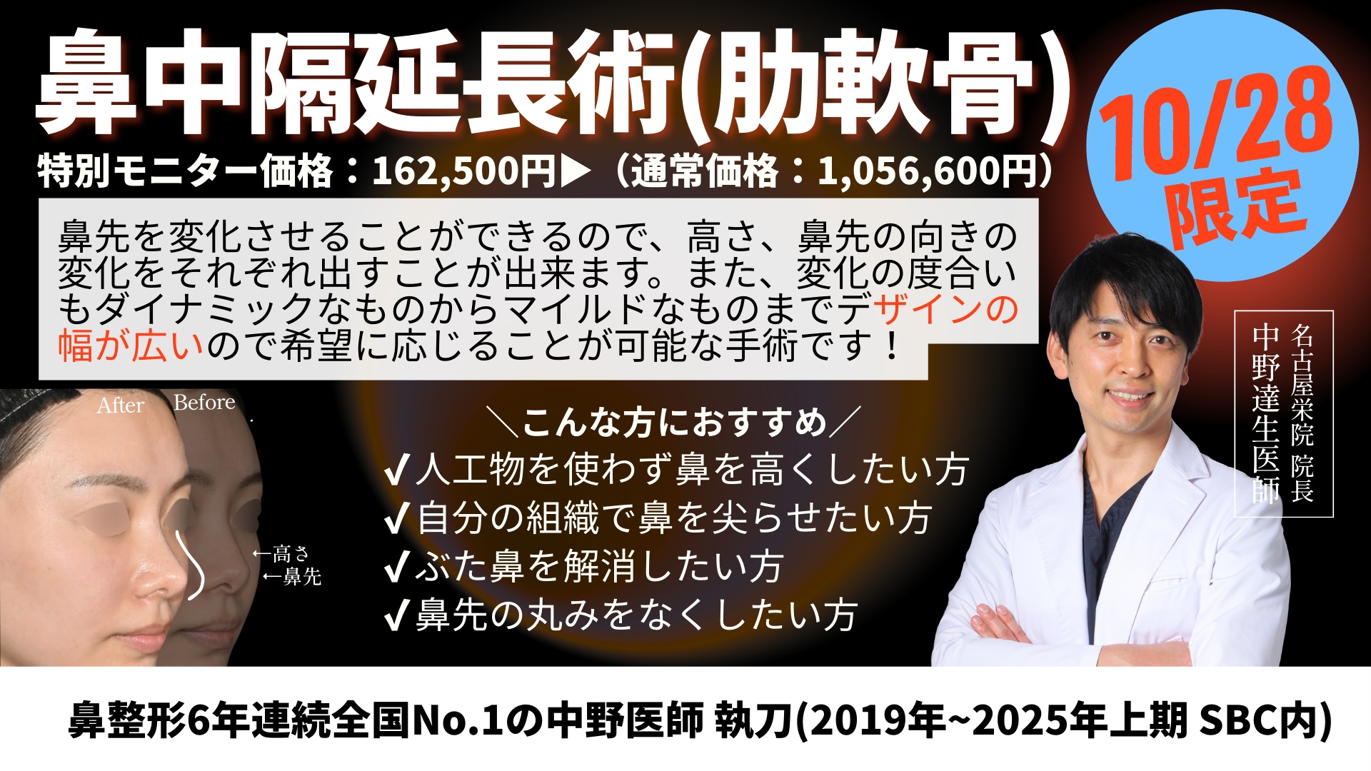 10/28限定　爆安コラボモニター募集中！！鼻整形症例数No.1の中野達生医師が執刀！！SBC内症例数