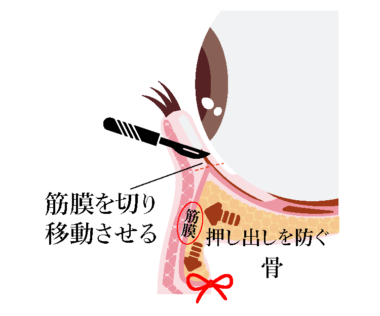 他とは違う独自工夫された裏ハムラ法とは