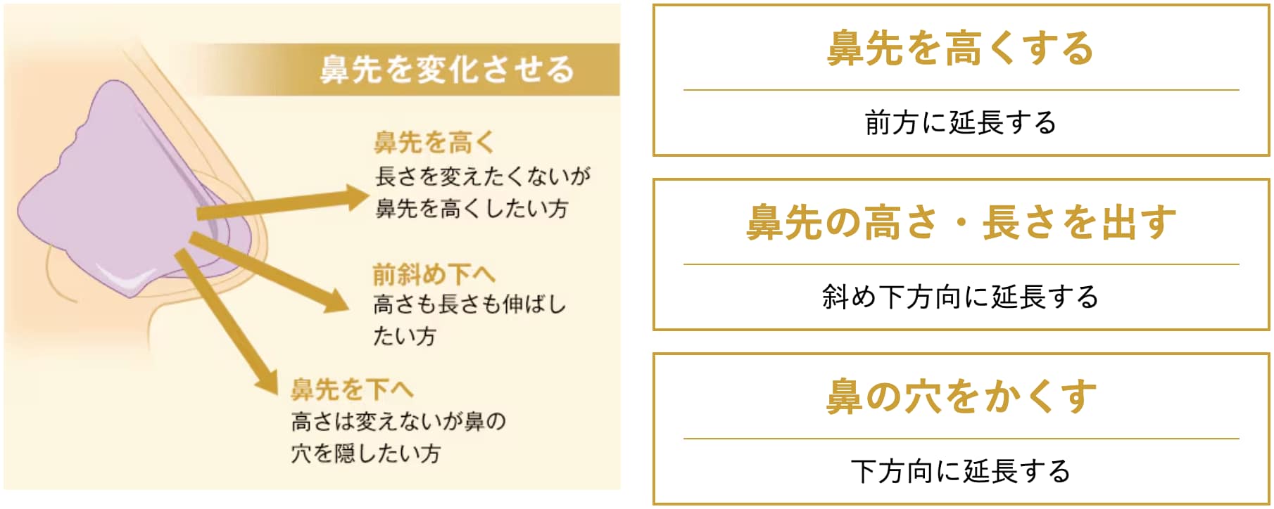 鼻中隔延長術の特徴