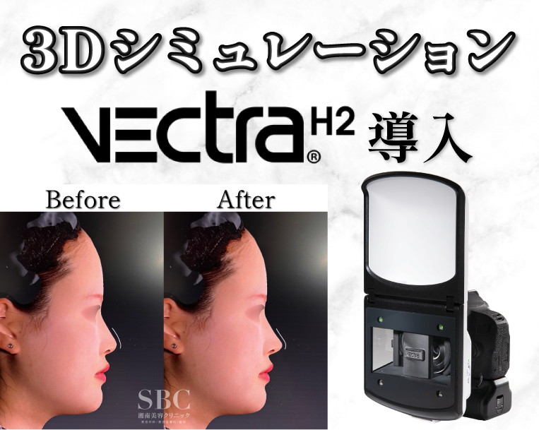 【最新3Dシミュレーション】ベクトラで実現する“忘れ鼻”中野医師だけの仕上がり再現