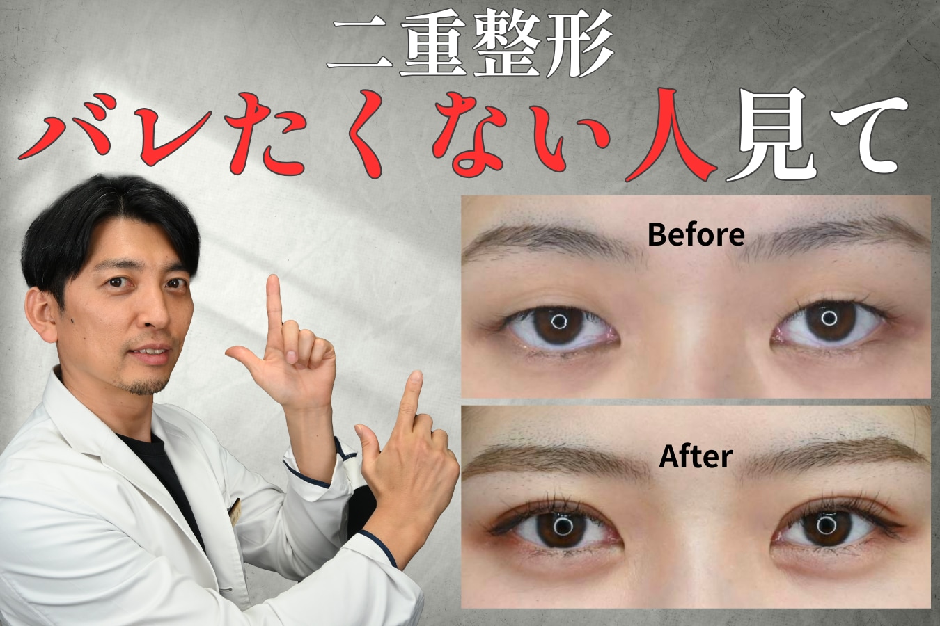 二重整形はバレない？自然に仕上げる方法とバレる原因を徹底解説