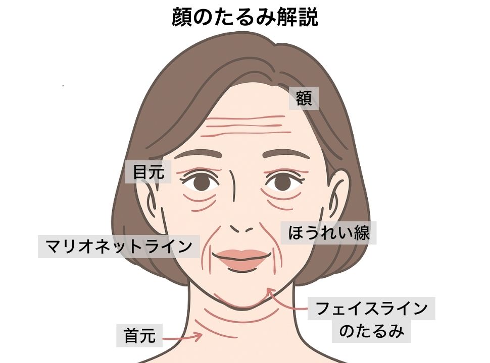 たるみが進むとどうなる？