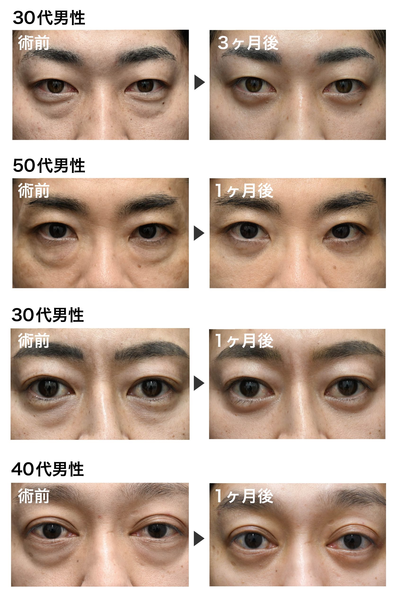 中野医師の男性クマ取り症例一覧