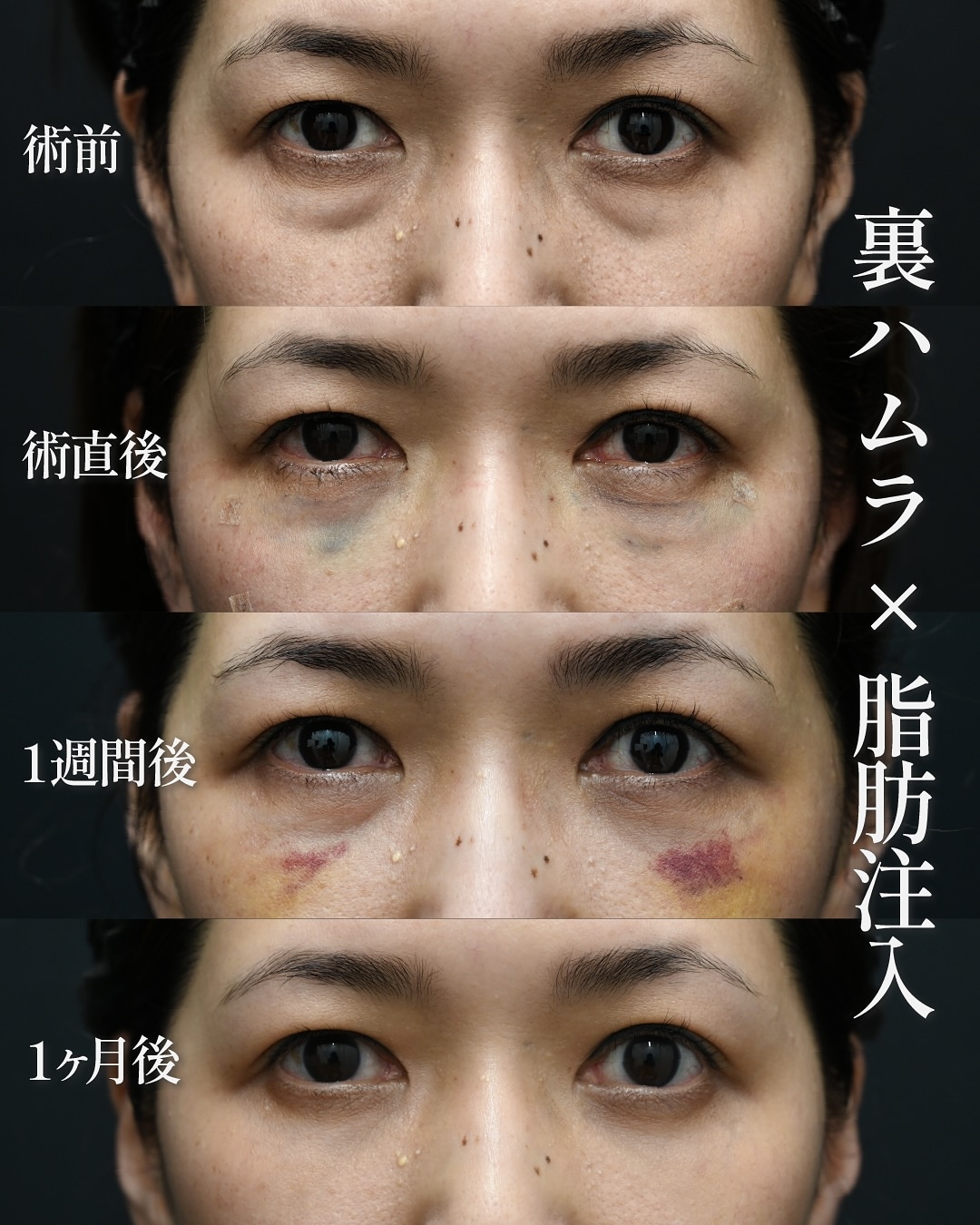 中野医師の神症例✨