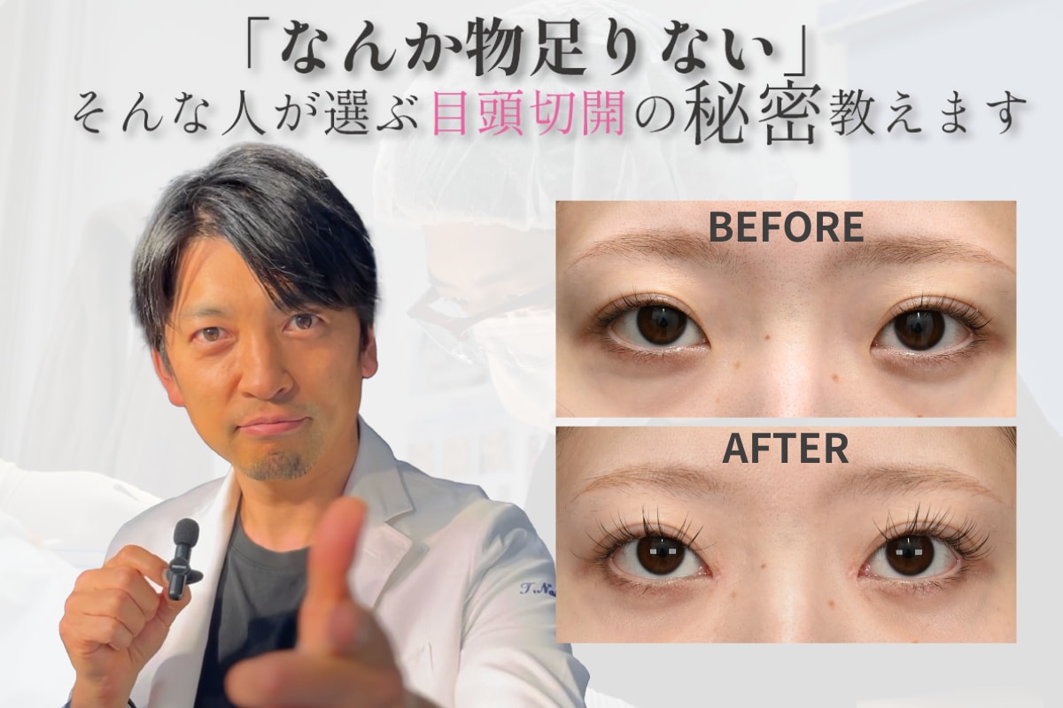 なんかもの足りない！そんな人が選ぶ目頭切開の秘密！
