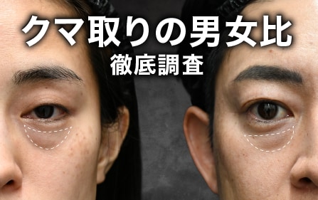 【実は男性も多い?】クマ取りの男女比を徹底調査!今や目元治療は“ジェンダーレス”の時代へ