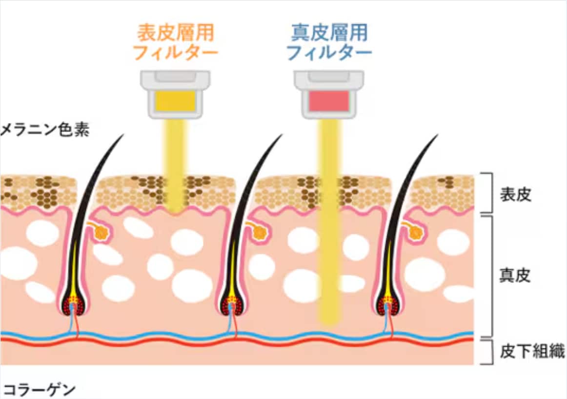 フォトダブル®