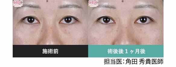 モフィウス8を施術したお客様の症例