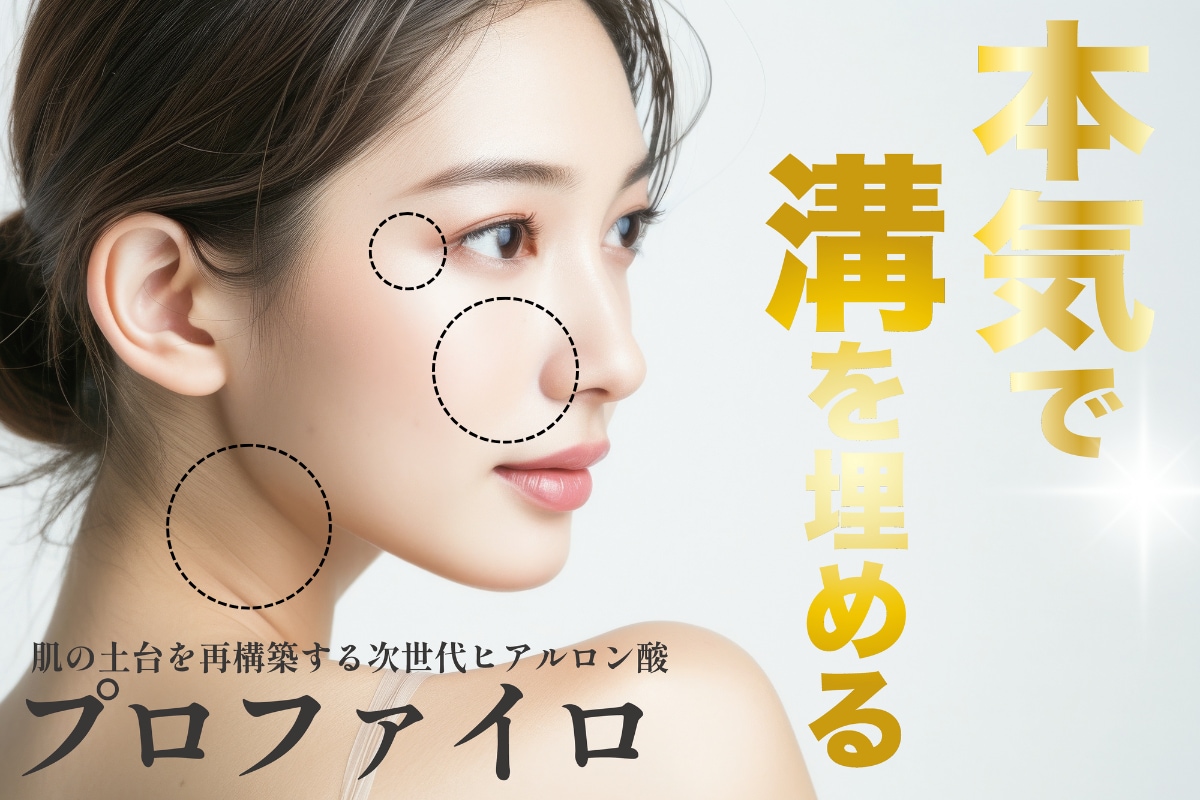 本気で溝を埋める！次世代ヒアルロン酸『プロファイロ』