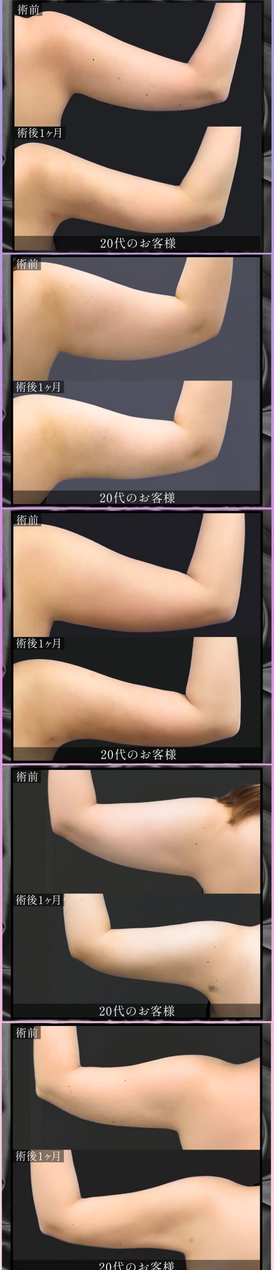 5人のお客様の症例写真