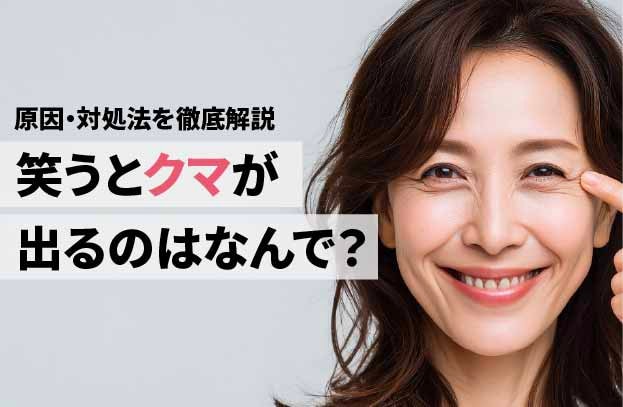 笑うとクマが出るのはなんで？｜悩みの原因と対処法を詳しく解説します！