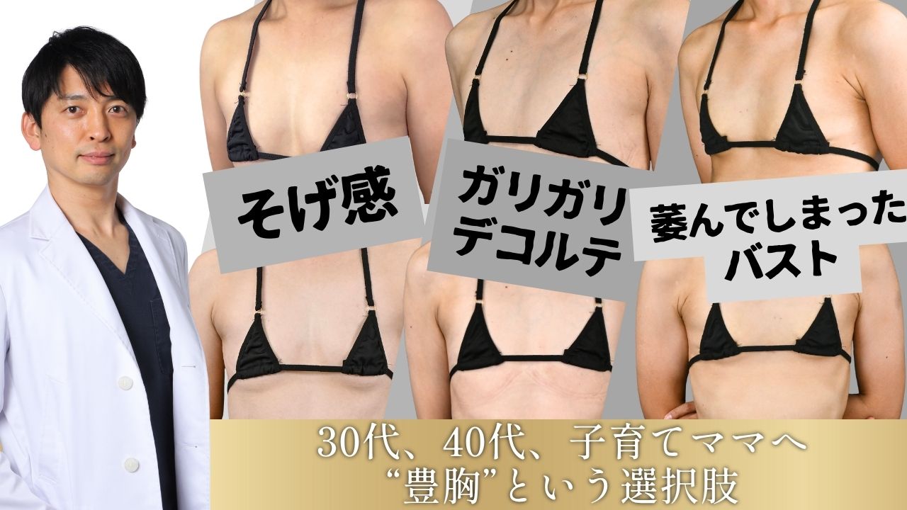 加齢の胸悩み・授乳後に｜30代40代＆ママが選ぶ失敗しない豊胸を症例で解説【SBC名古屋栄院】