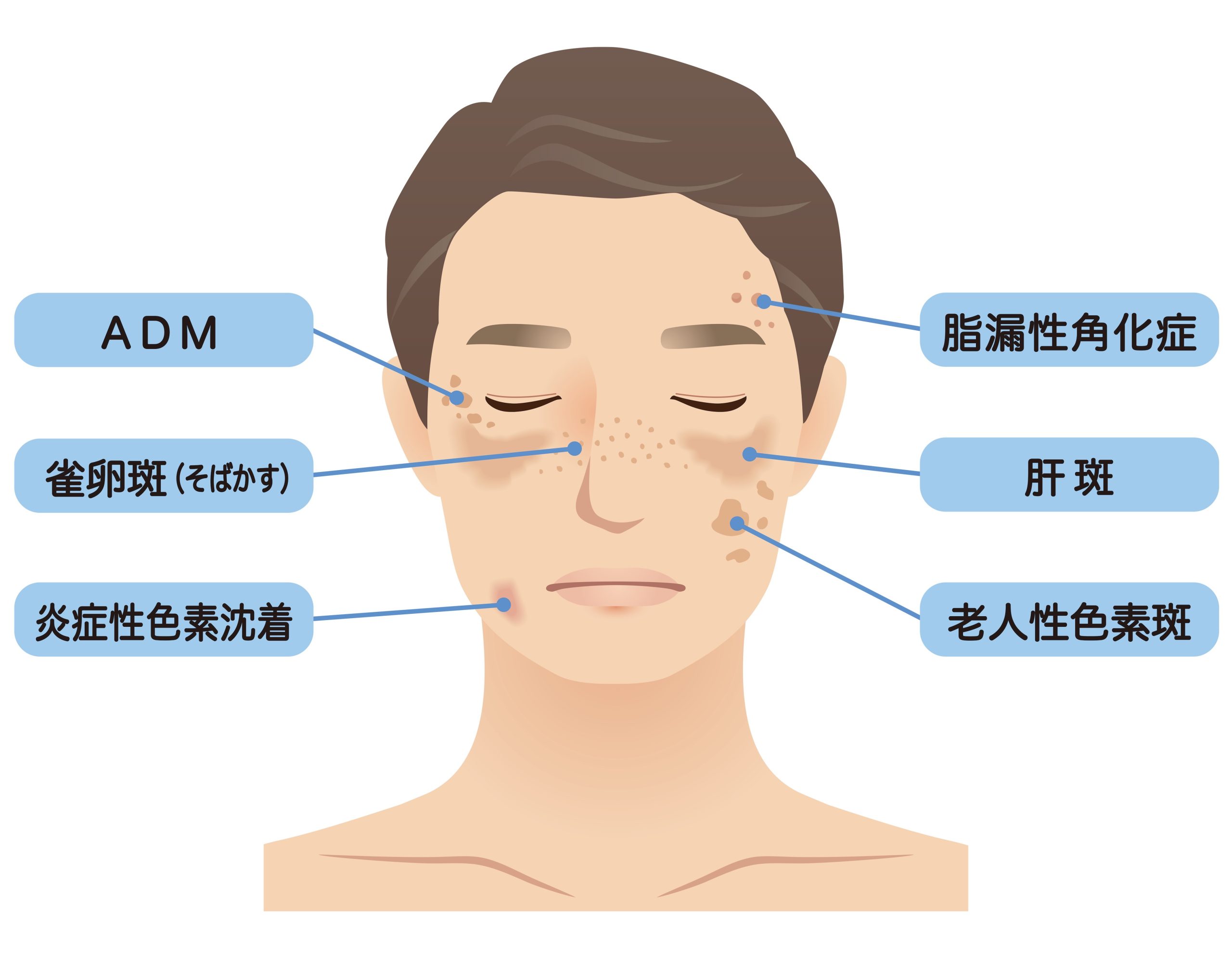 まずは“自分のシミを知ること”から