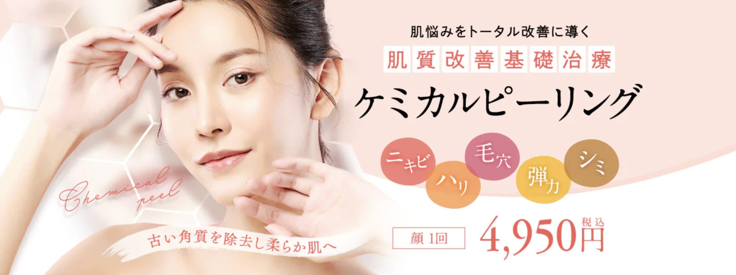 ケミカルピーリング