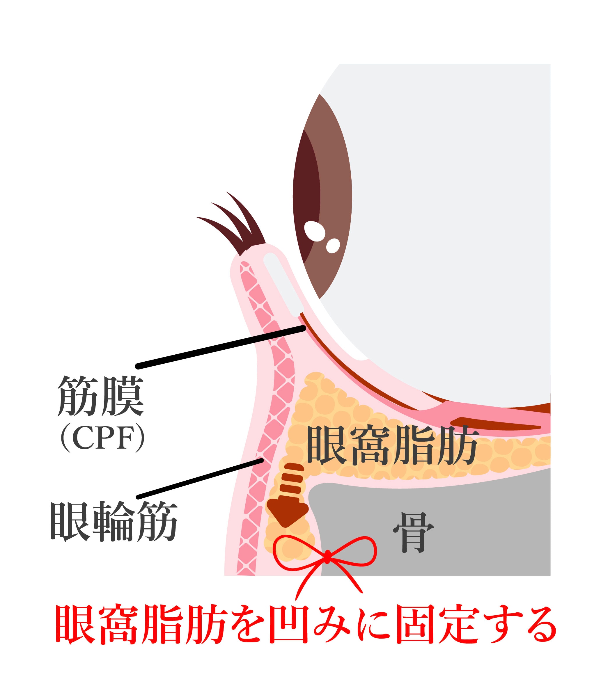 裏ハムラ法とは