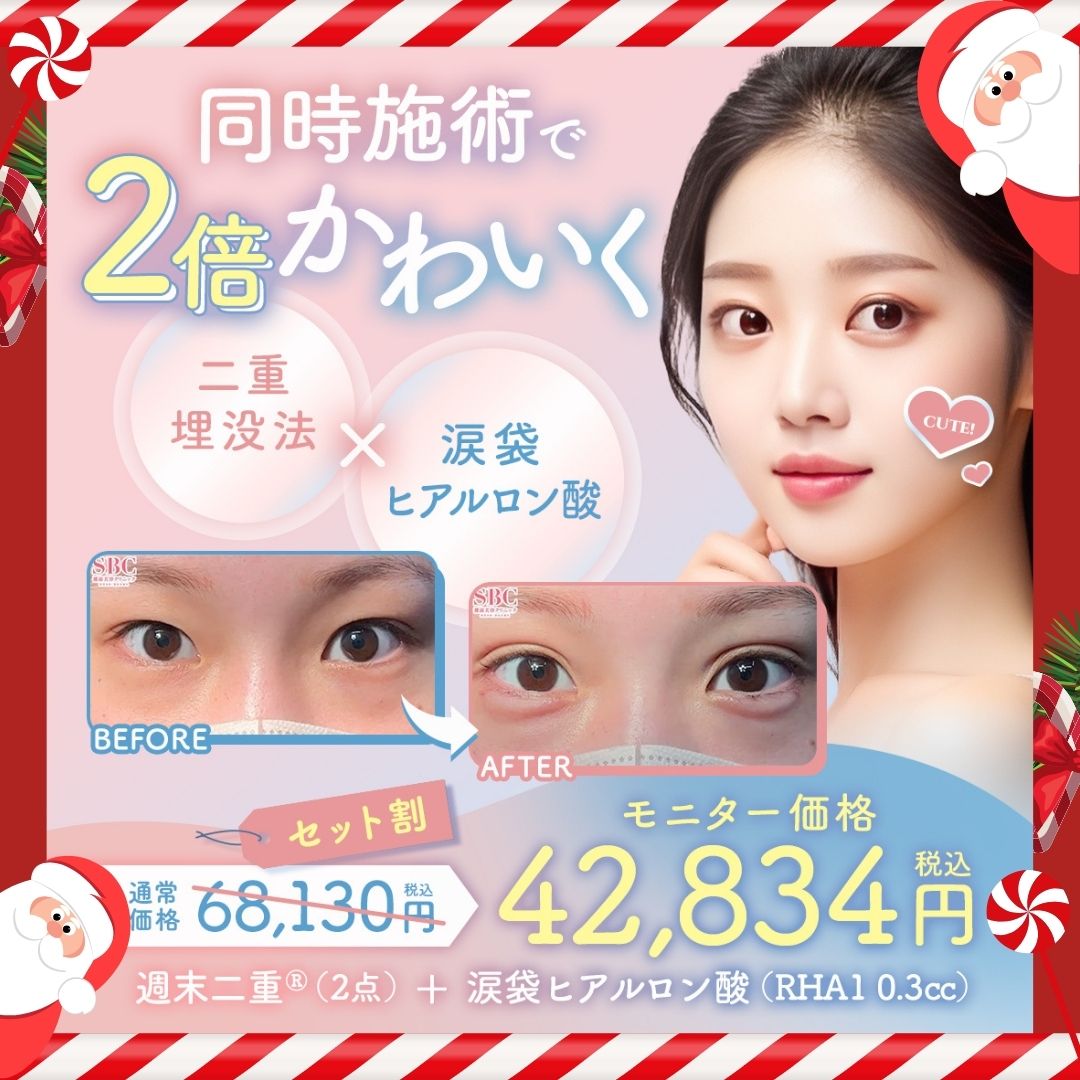 12_25④二重×涙袋_SBC名古屋栄院からのお得なキャンペーン情報!