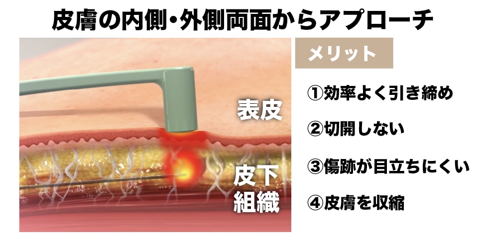 話題のエンブレイスについて解説