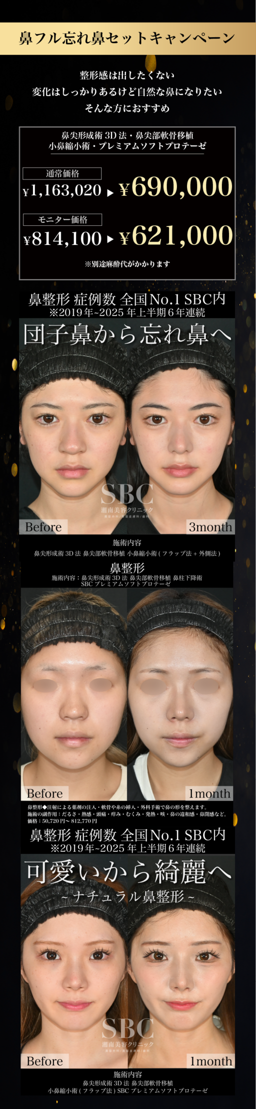 鼻フル忘れ鼻セットキャンペーン