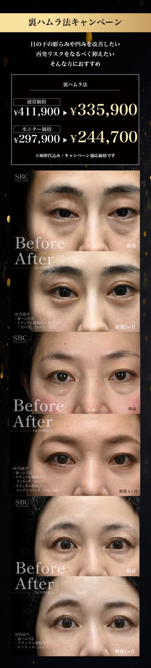 クマ取り20％OFFキャンペーン