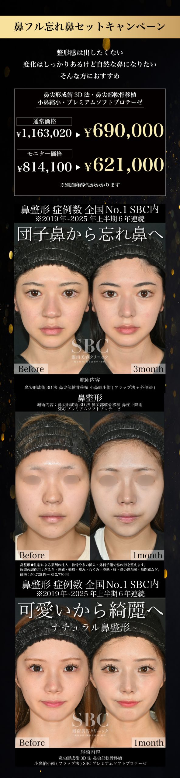 鼻フル忘れ鼻セット