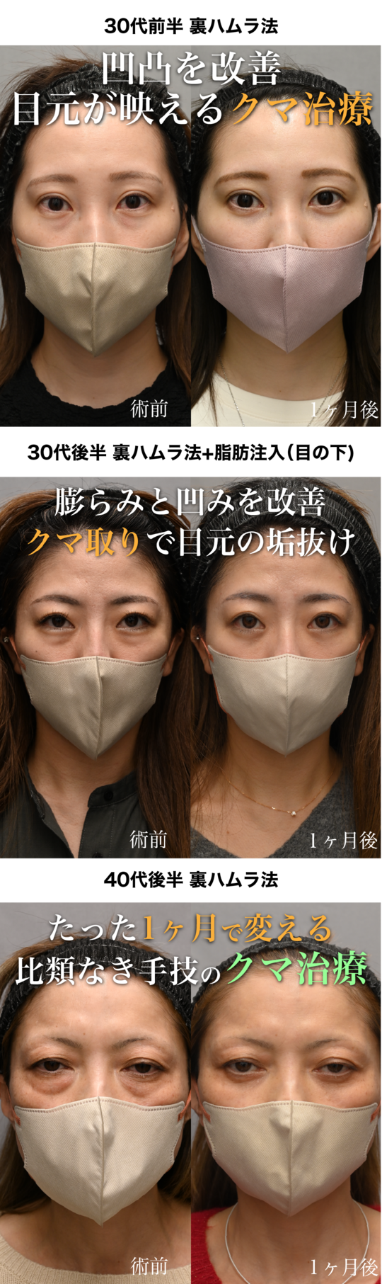 実は写真写りを大きく左右するのは「目元のクマ」