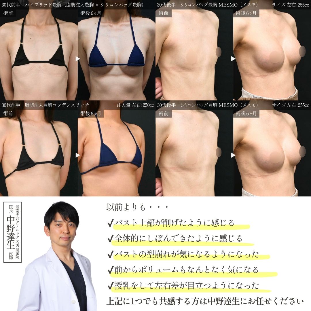 中野達生医師の豊胸が選ばれる理由