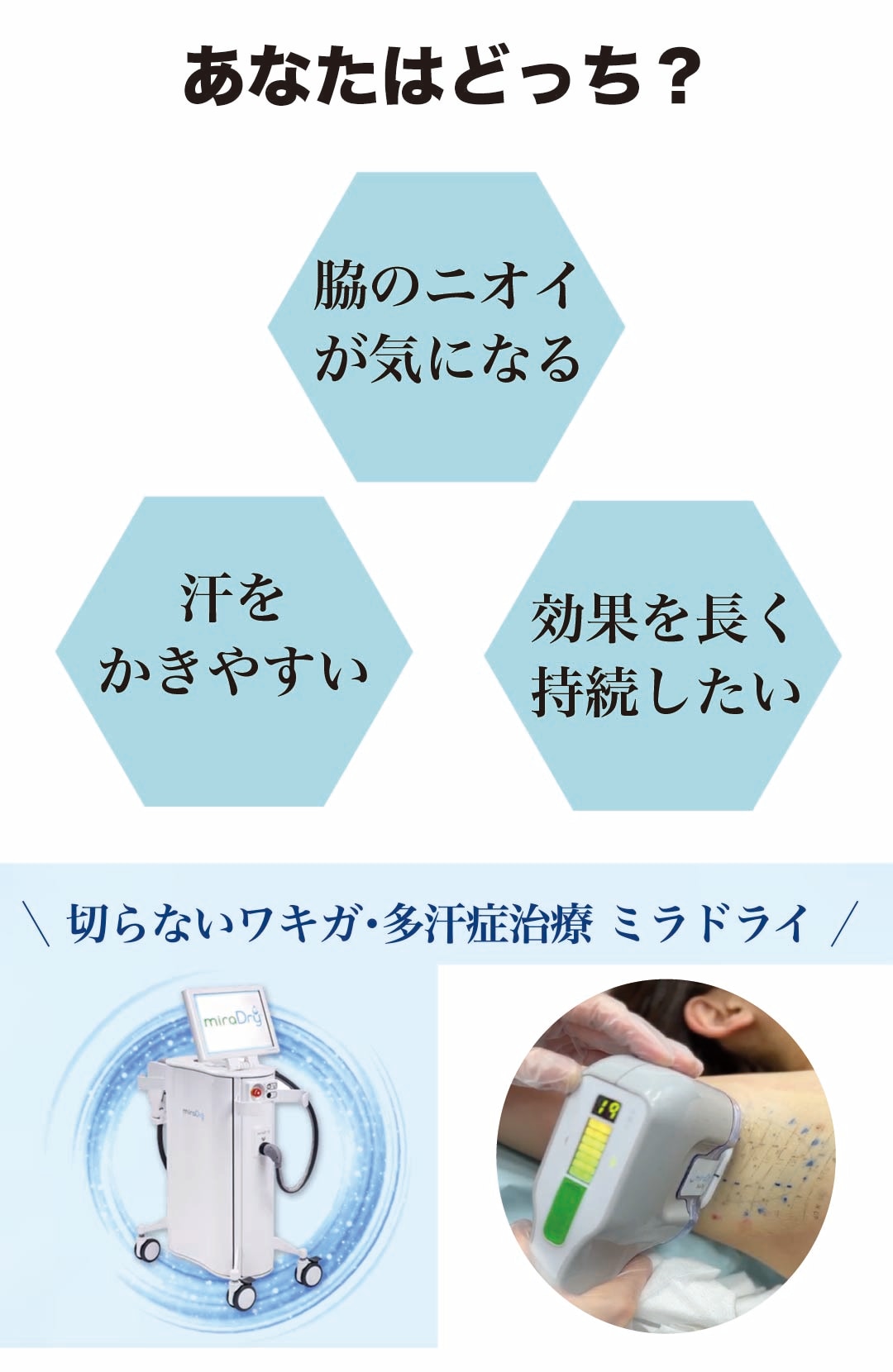 ミラドライ