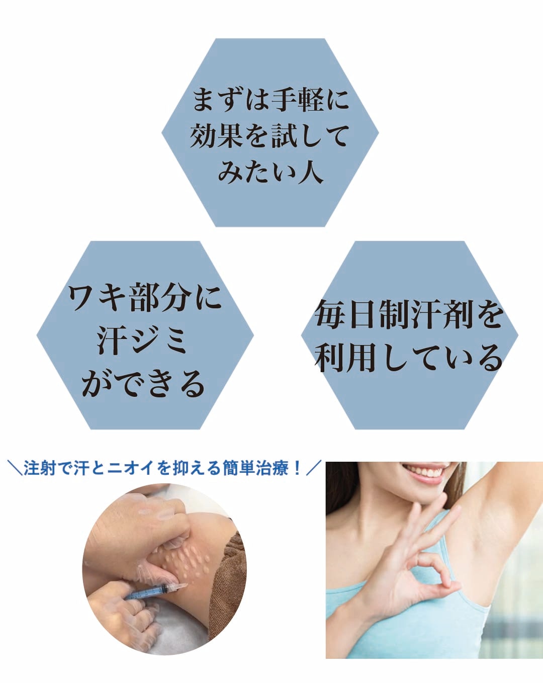 脇ボトックス
